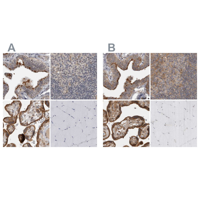 LRRC45 Antibody in Immunohistochemistry (IHC)