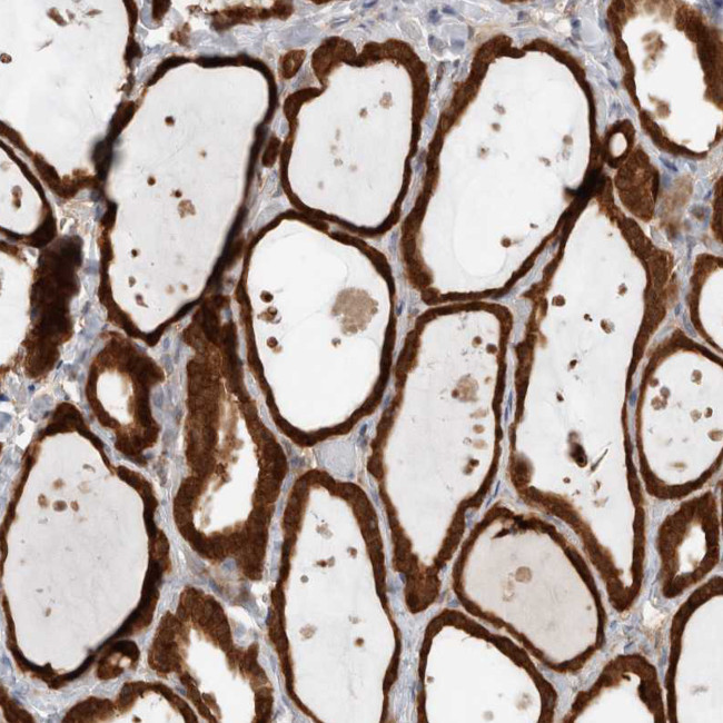KLHL14 Antibody in Immunohistochemistry (Paraffin) (IHC (P))