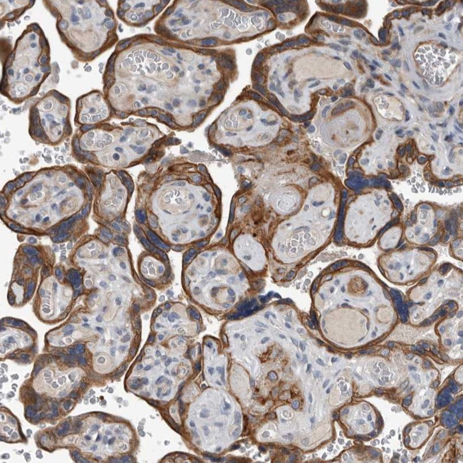 DPY19L4 Antibody in Immunohistochemistry (Paraffin) (IHC (P))