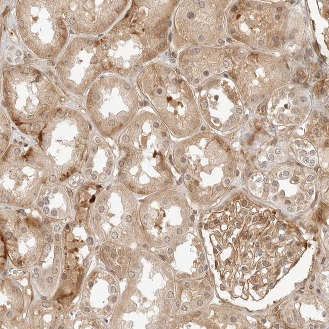 GEM Antibody in Immunohistochemistry (Paraffin) (IHC (P))