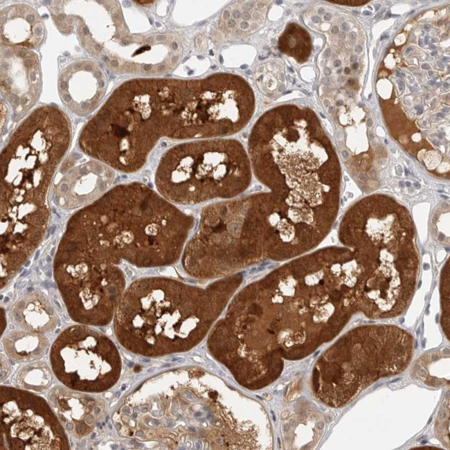 CTIF Antibody in Immunohistochemistry (Paraffin) (IHC (P))