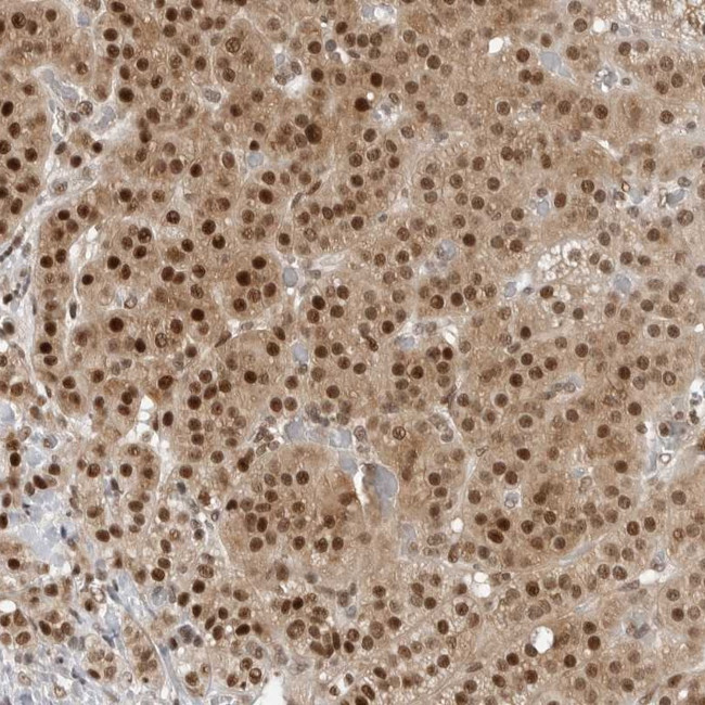 C8orf33 Antibody in Immunohistochemistry (Paraffin) (IHC (P))