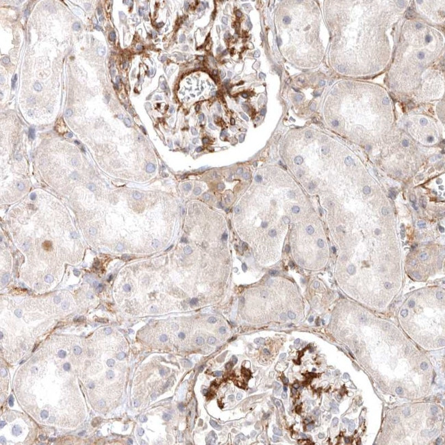 LONRF1 Antibody in Immunohistochemistry (Paraffin) (IHC (P))