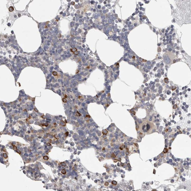 FBXO43 Antibody in Immunohistochemistry (Paraffin) (IHC (P))