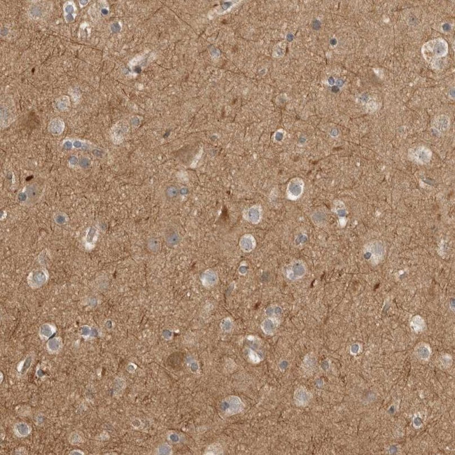 CUEDC1 Antibody in Immunohistochemistry (IHC)