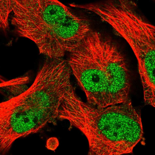 C17orf71 Antibody in Immunocytochemistry (ICC/IF)