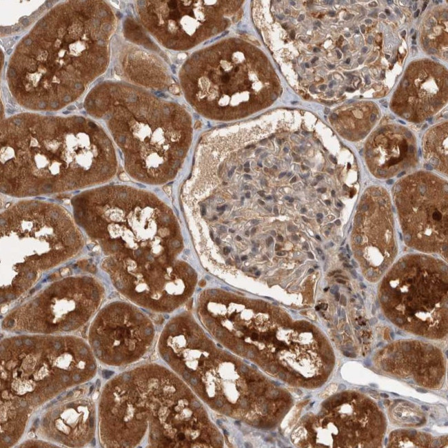 PLEKHM1 Antibody in Immunohistochemistry (Paraffin) (IHC (P))