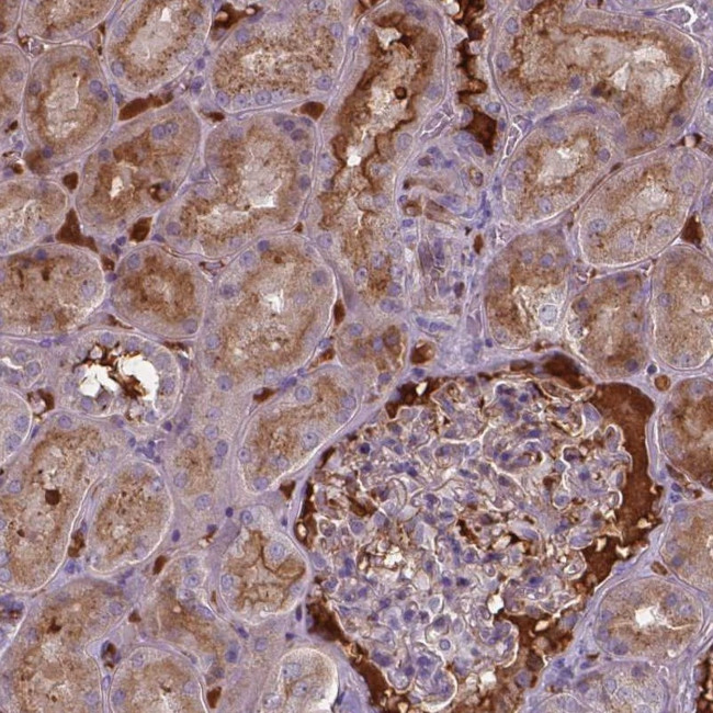 BTBD17 Antibody in Immunohistochemistry (Paraffin) (IHC (P))
