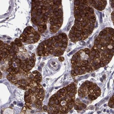KIF13B Antibody in Immunohistochemistry (Paraffin) (IHC (P))