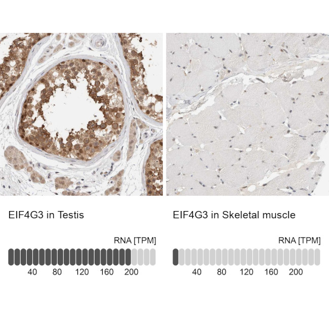 eIF4G3 Antibody in Immunohistochemistry (IHC)