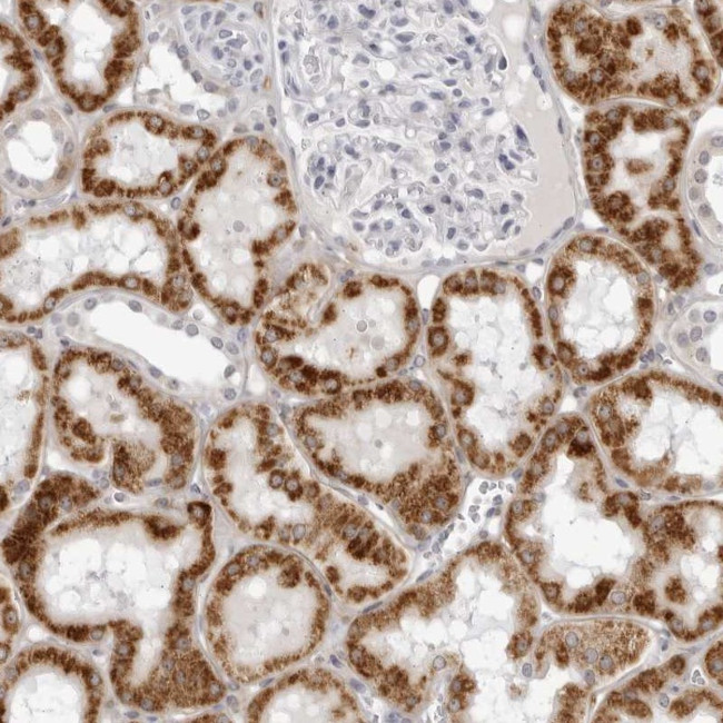 CNBD1 Antibody in Immunohistochemistry (Paraffin) (IHC (P))