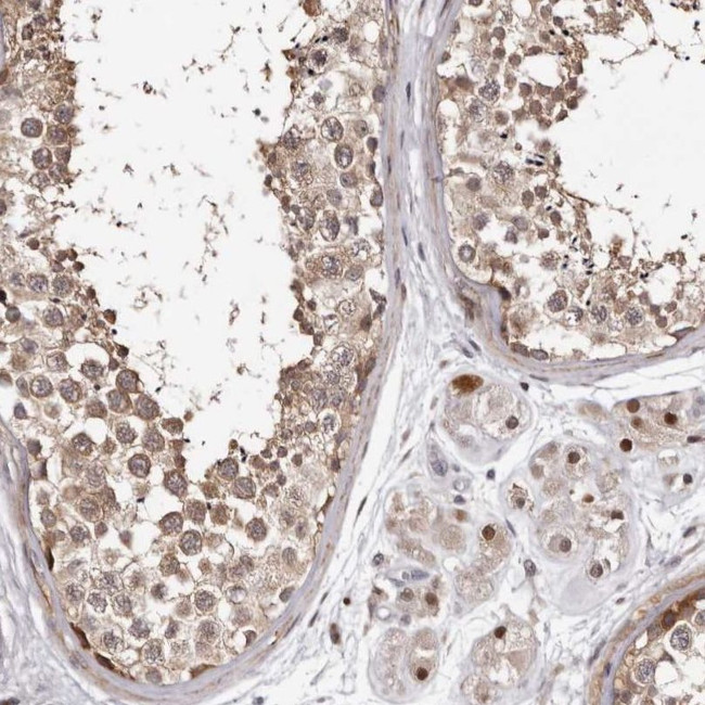 PHF20L1 Antibody in Immunohistochemistry (IHC)