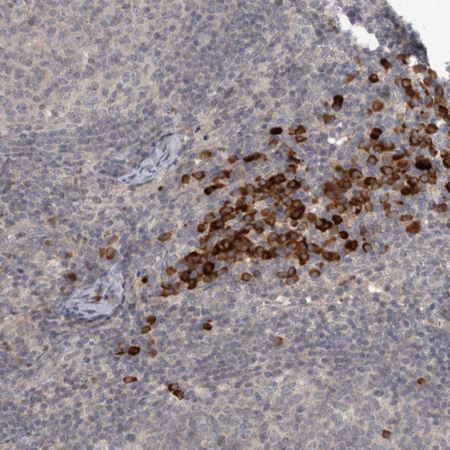 SLCO5A1 Antibody in Immunohistochemistry (Paraffin) (IHC (P))