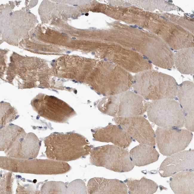 PEBP4 Antibody in Immunohistochemistry (Paraffin) (IHC (P))