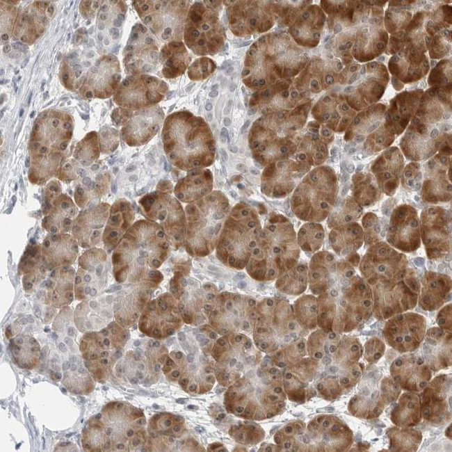 C8orf48 Antibody in Immunohistochemistry (Paraffin) (IHC (P))