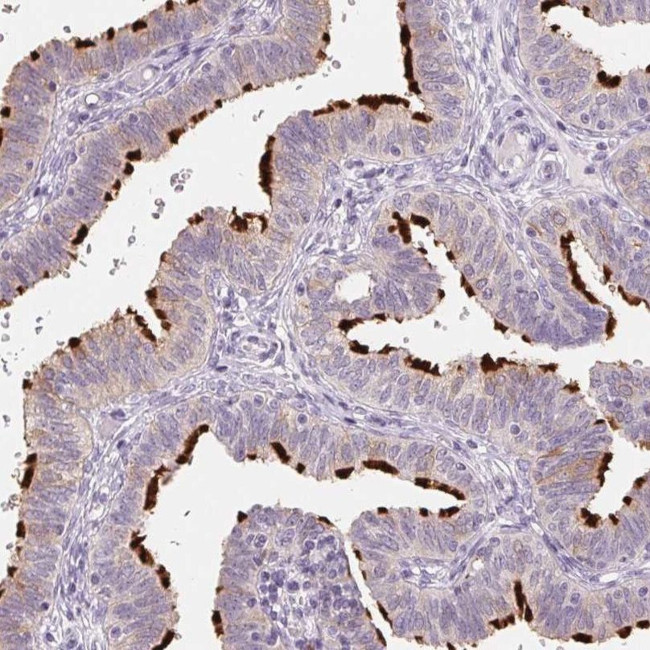 ERICH5 Antibody in Immunohistochemistry (IHC)