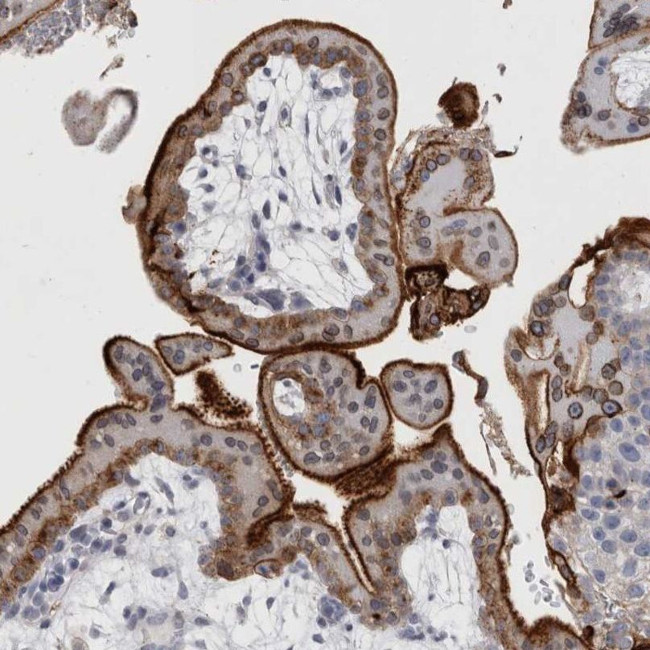 DNAJC24 Antibody in Immunohistochemistry (IHC)