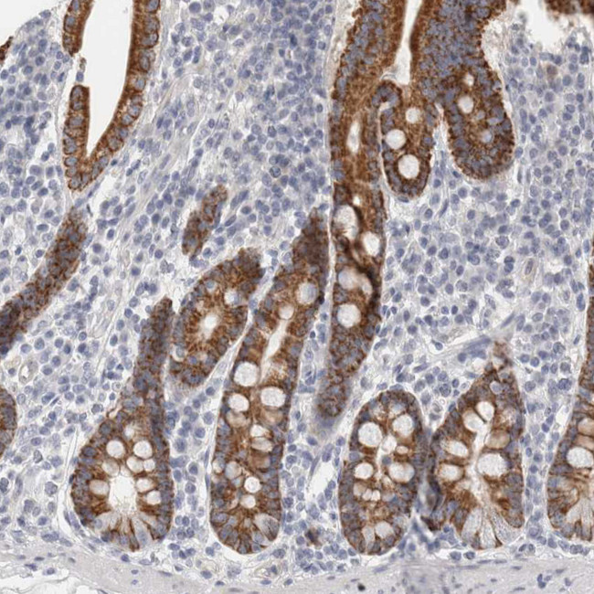 FBLIM1 Antibody in Immunohistochemistry (Paraffin) (IHC (P))
