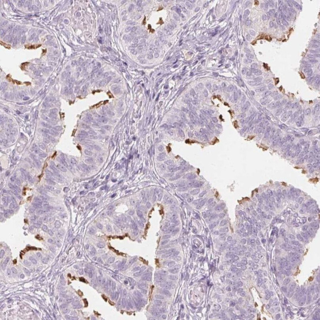 ERICH5 Antibody in Immunohistochemistry (IHC)