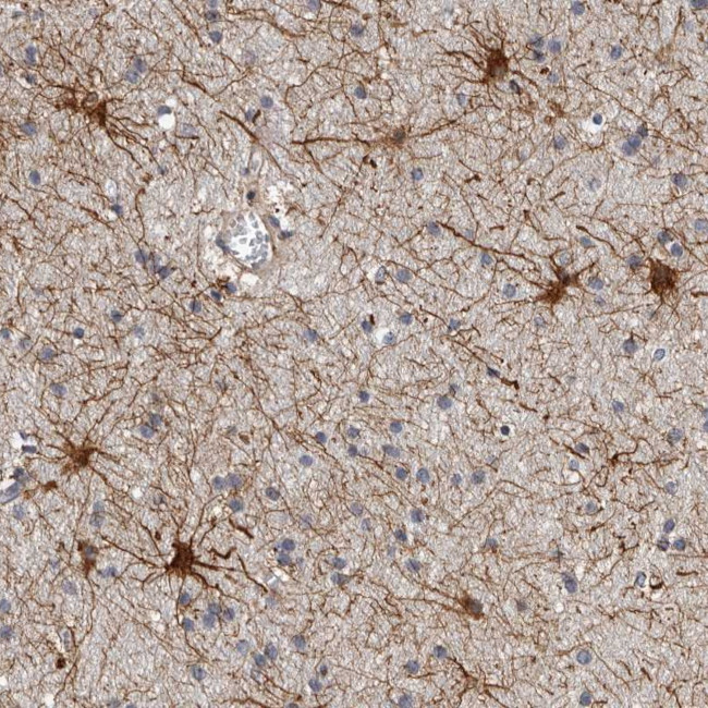 ADCK5 Antibody in Immunohistochemistry (Paraffin) (IHC (P))
