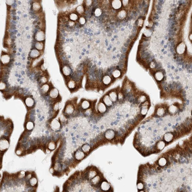 PCMTD1 Antibody in Immunohistochemistry (Paraffin) (IHC (P))