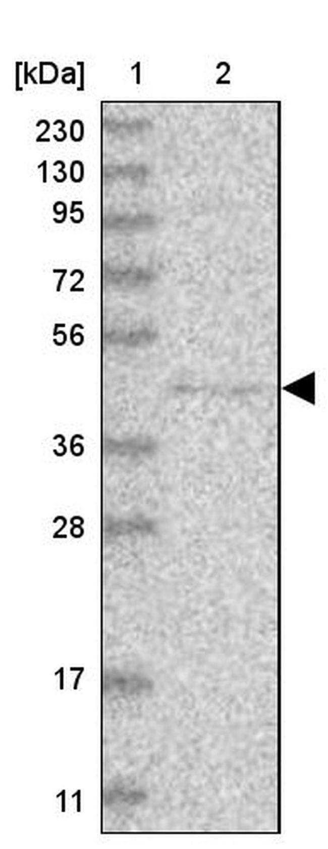 PCMTD1 Antibody in Western Blot (WB)