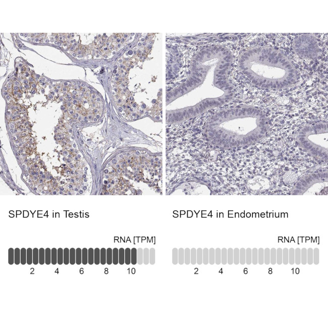 SPDYE4 Antibody in Immunohistochemistry (IHC)