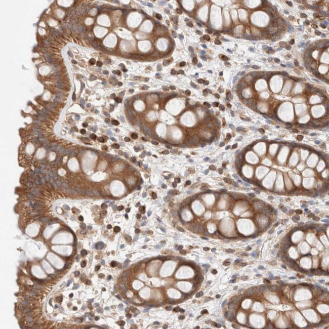 SIKE Antibody in Immunohistochemistry (Paraffin) (IHC (P))