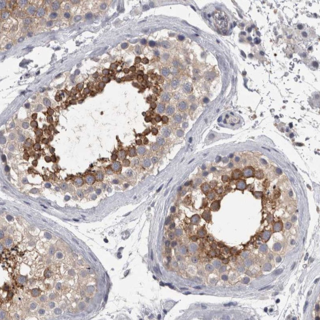 LYZL6 Antibody in Immunohistochemistry (Paraffin) (IHC (P))