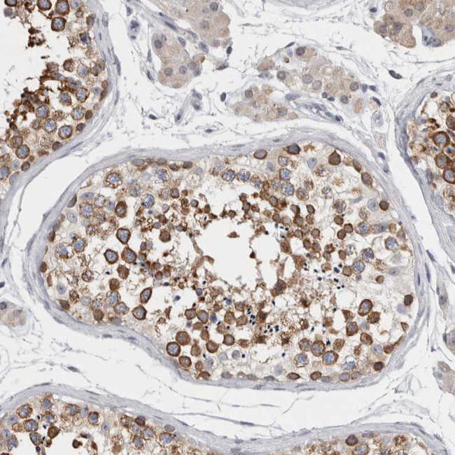 TMEM242 Antibody in Immunohistochemistry (Paraffin) (IHC (P))