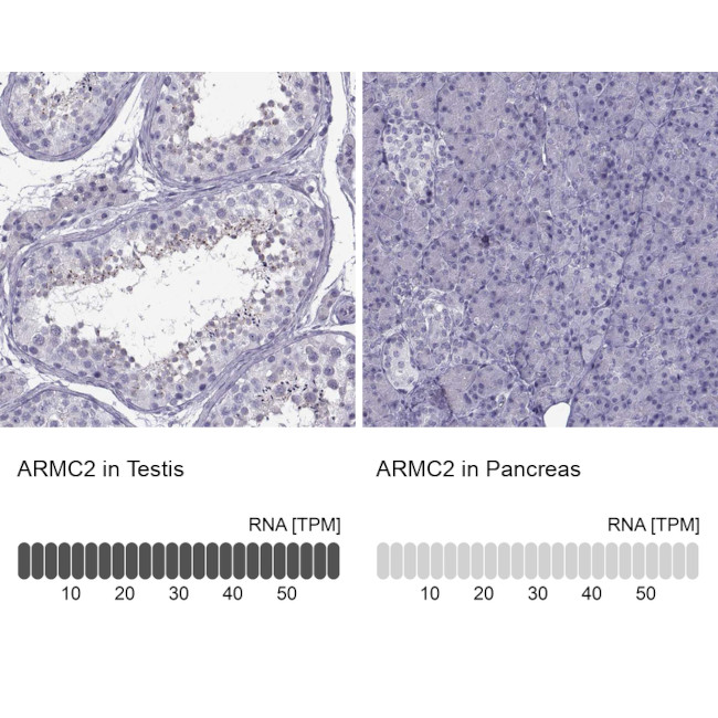 ARMC2 Antibody in Immunohistochemistry (IHC)