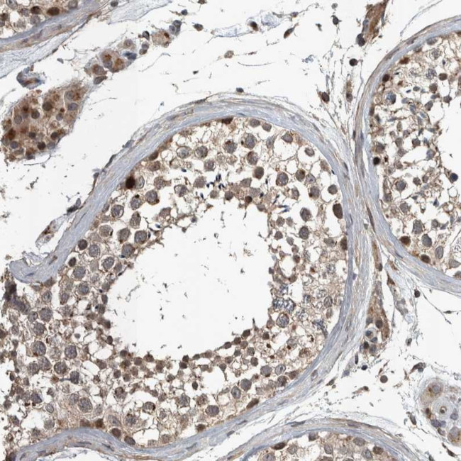 ZNF345 Antibody in Immunohistochemistry (Paraffin) (IHC (P))