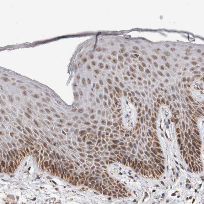 MRPL37 Antibody in Immunohistochemistry (Paraffin) (IHC (P))