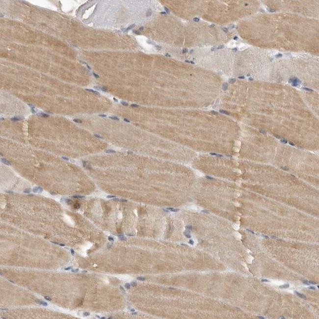 Phafin 1 Antibody in Immunohistochemistry (IHC)