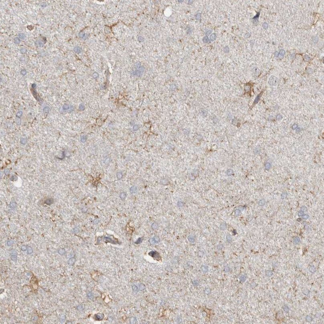 REPS2 Antibody in Immunohistochemistry (IHC)