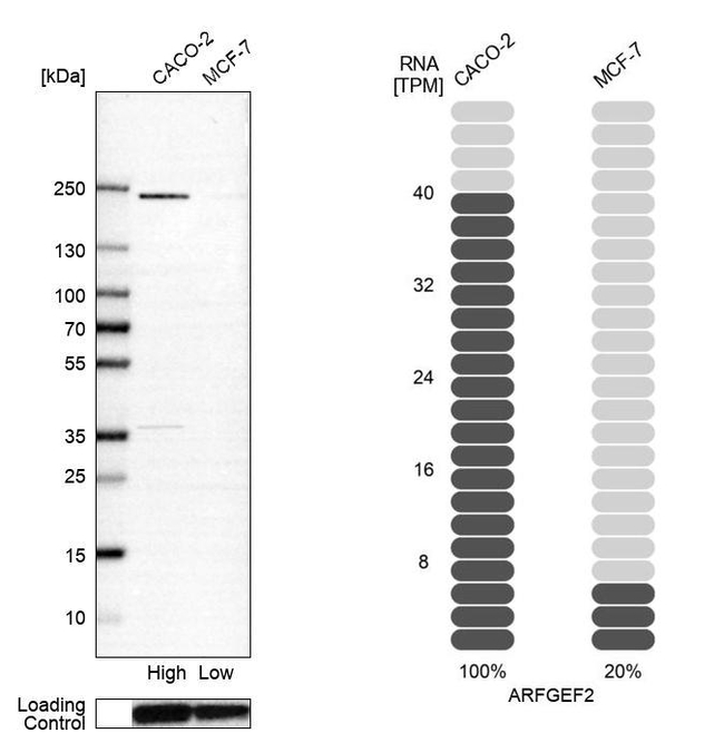 ARFGEF2 Antibody in Western Blot (WB)