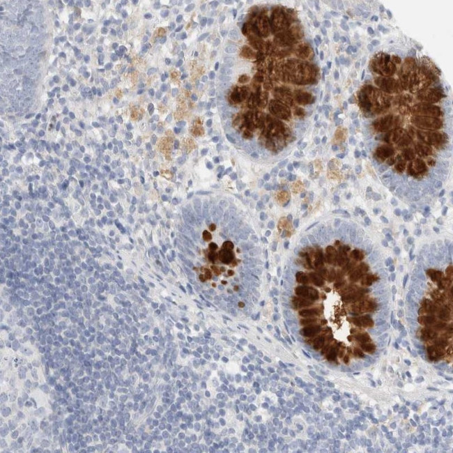 ADAM30 Antibody in Immunohistochemistry (Paraffin) (IHC (P))