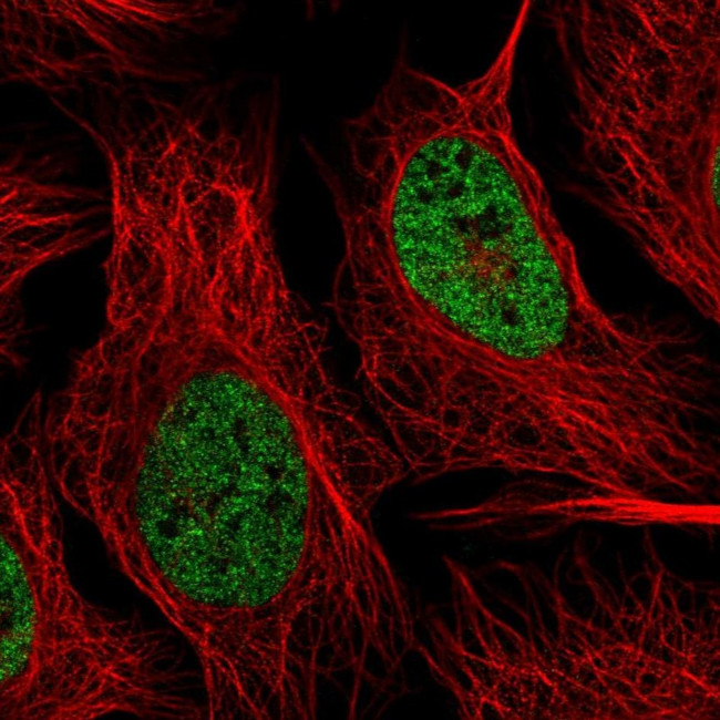 hnRNP R Antibody in Immunocytochemistry (ICC/IF)