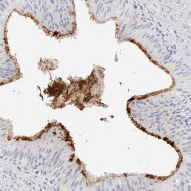 MUC15 Antibody in Immunohistochemistry (IHC)