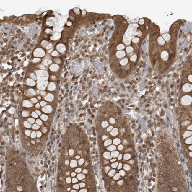 DNAJC8 Antibody in Immunohistochemistry (Paraffin) (IHC (P))