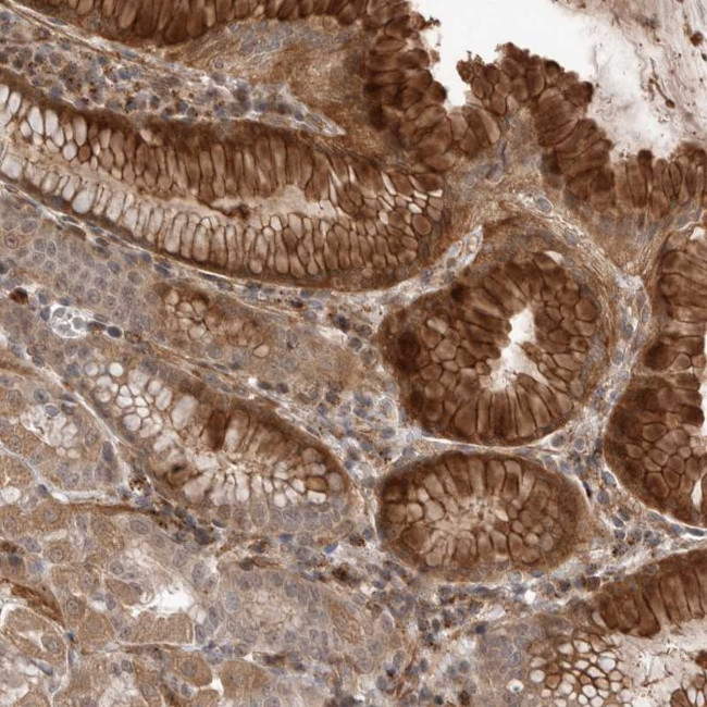 PEAK1 Antibody in Immunohistochemistry (Paraffin) (IHC (P))