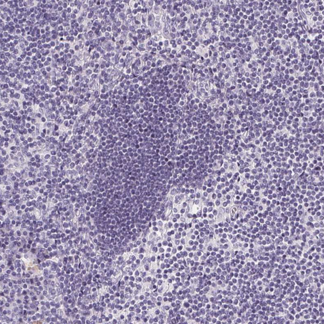 GSDMC Antibody in Immunohistochemistry (Paraffin) (IHC (P))