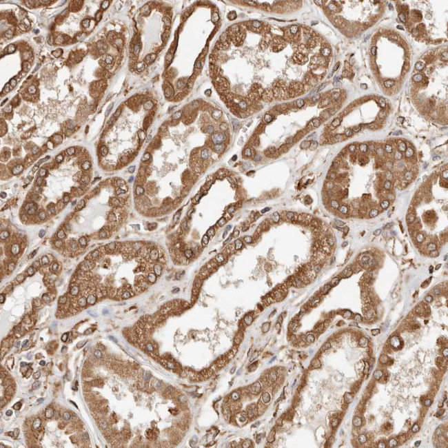 ARHGEF10L Antibody in Immunohistochemistry (Paraffin) (IHC (P))