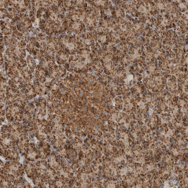 BIKE Antibody in Immunohistochemistry (Paraffin) (IHC (P))