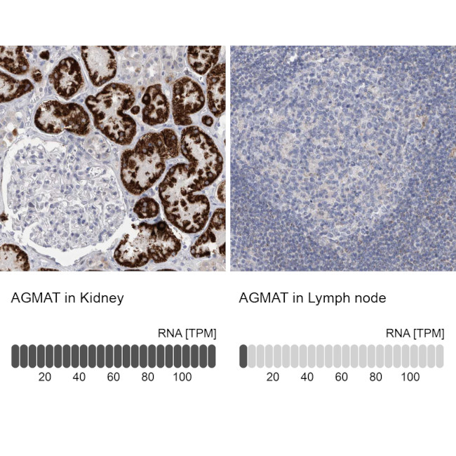 AGMAT Antibody in Immunohistochemistry (IHC)
