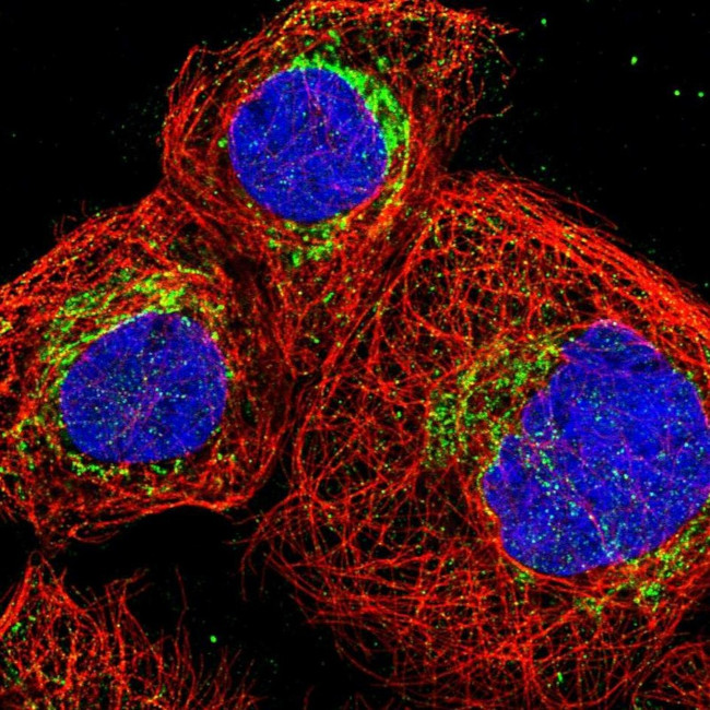 DBT Antibody in Immunocytochemistry (ICC/IF)