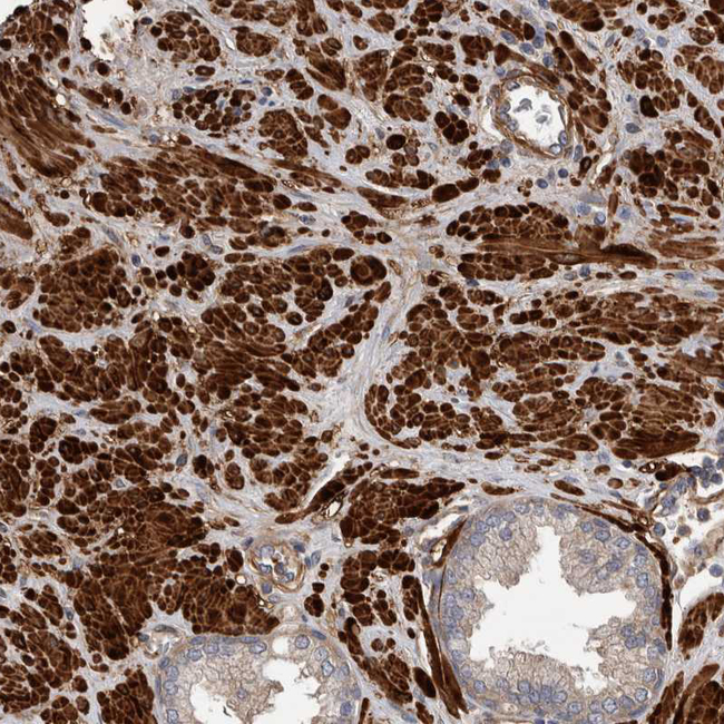 EPRS Antibody in Immunohistochemistry (Paraffin) (IHC (P))