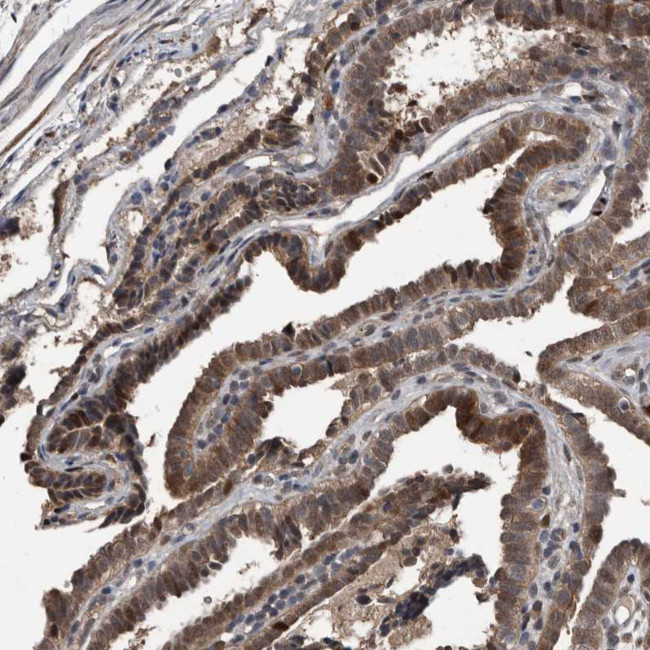 FSBP Antibody in Immunohistochemistry (Paraffin) (IHC (P))