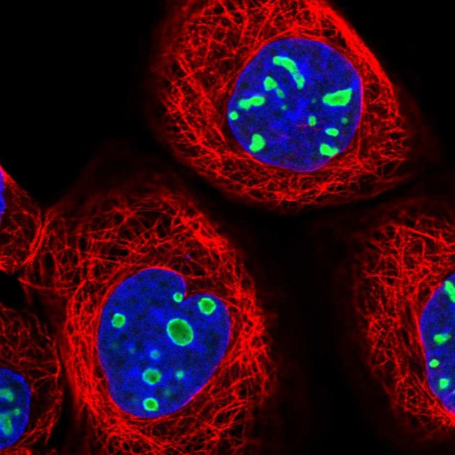 EBNA1BP2 Antibody in Immunocytochemistry (ICC/IF)