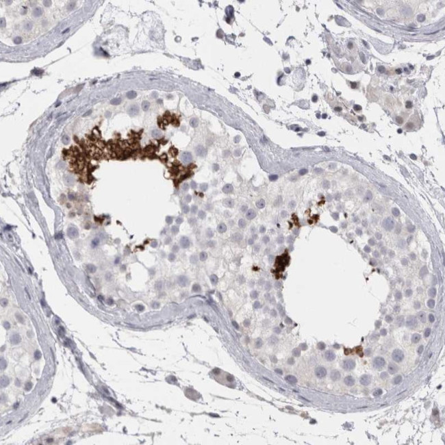 FNDC8 Antibody in Immunohistochemistry (Paraffin) (IHC (P))